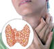 Лечение щитовидной железы. Где находится и за что отвечает щитовидная железа.  Симптомы нарушения работы, гипофункция и гиперфункция.
